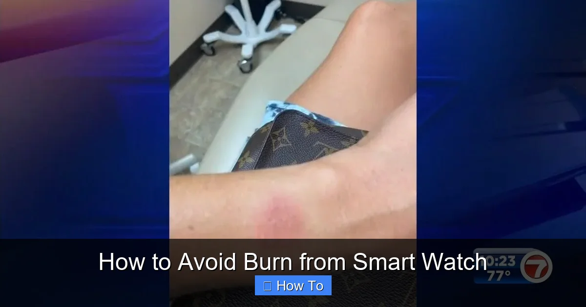 How to Avoid Burn from Smart Watch